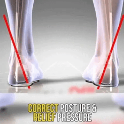 Foot and ankle alignment illustration for footwear support